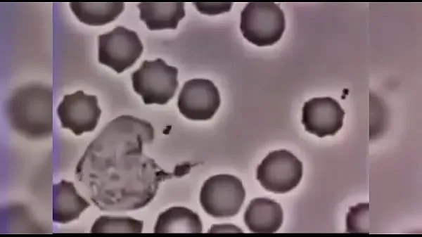 Nuovi White Cell Fucking Bacteria (Before It Fucks The Human Body) To The Sound Of Linkin Parkclip principali