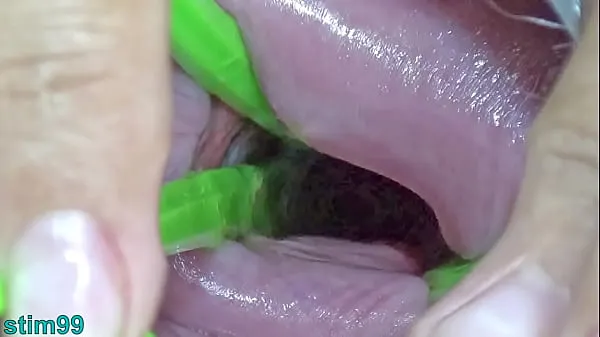 Nuovi Cervix Dilatation | Stretching the Cervix with Sextoysclip principali